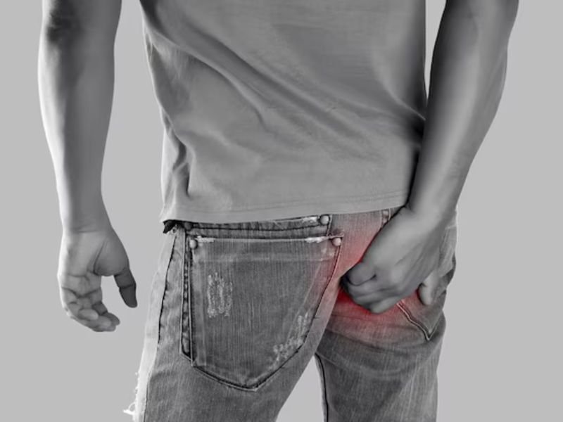 Is Fissure a Genetic Problem? What Current Research Says About Fissure Treatment