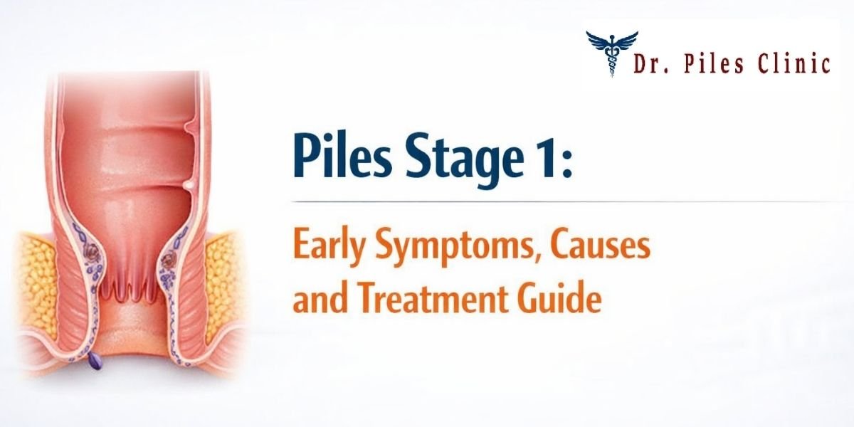 Diagram showing piles grades 1 to 4 with symptoms and progression stages