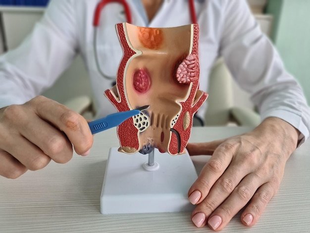 Best Piles Clinic in Noida