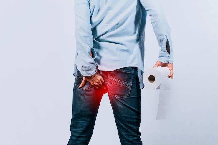 Piles Treatment in Noida Finding the Right Approach for Your Condition - Dr. Piles Clinic